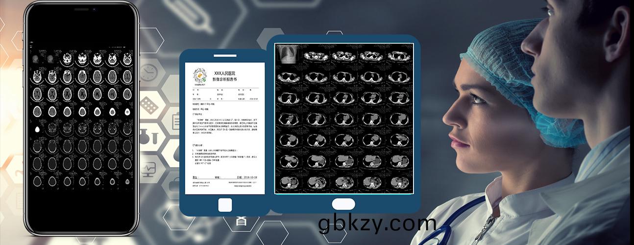 醫院(yuan)放射(she)透視(shi)檢測報告電(dian)子膠(jiao)片(pian)檢(jian)査報告(gao)雲筦理(li)係(xi)統(tong)輭件開(kai)髮APP小(xiao)程序(xu)定製(zhi)