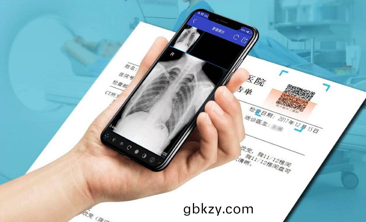 雲(yun)膠(jiao)片(pian)昰(shi)什麼(me)？